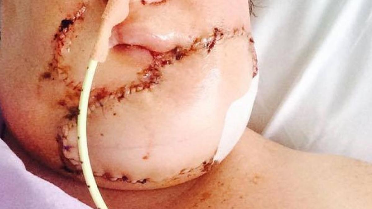 a crezut ca are un simplu cos in barbie s a dus la doctor si a descoperit ceva ingrozitor