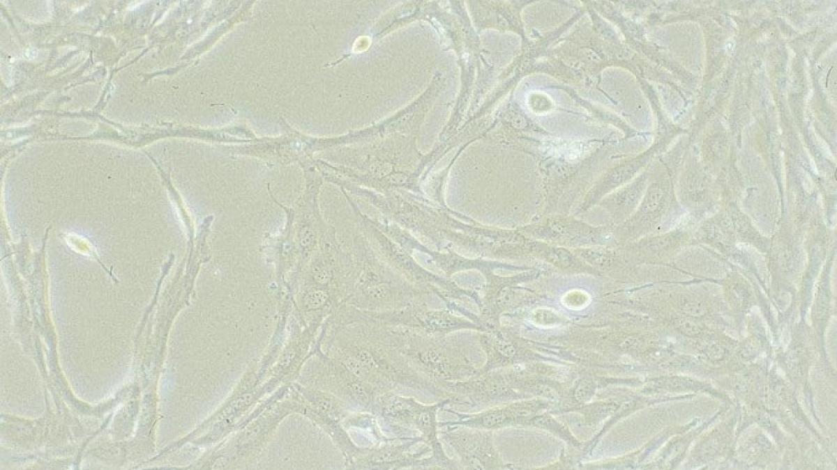 tratament experimental scleroza