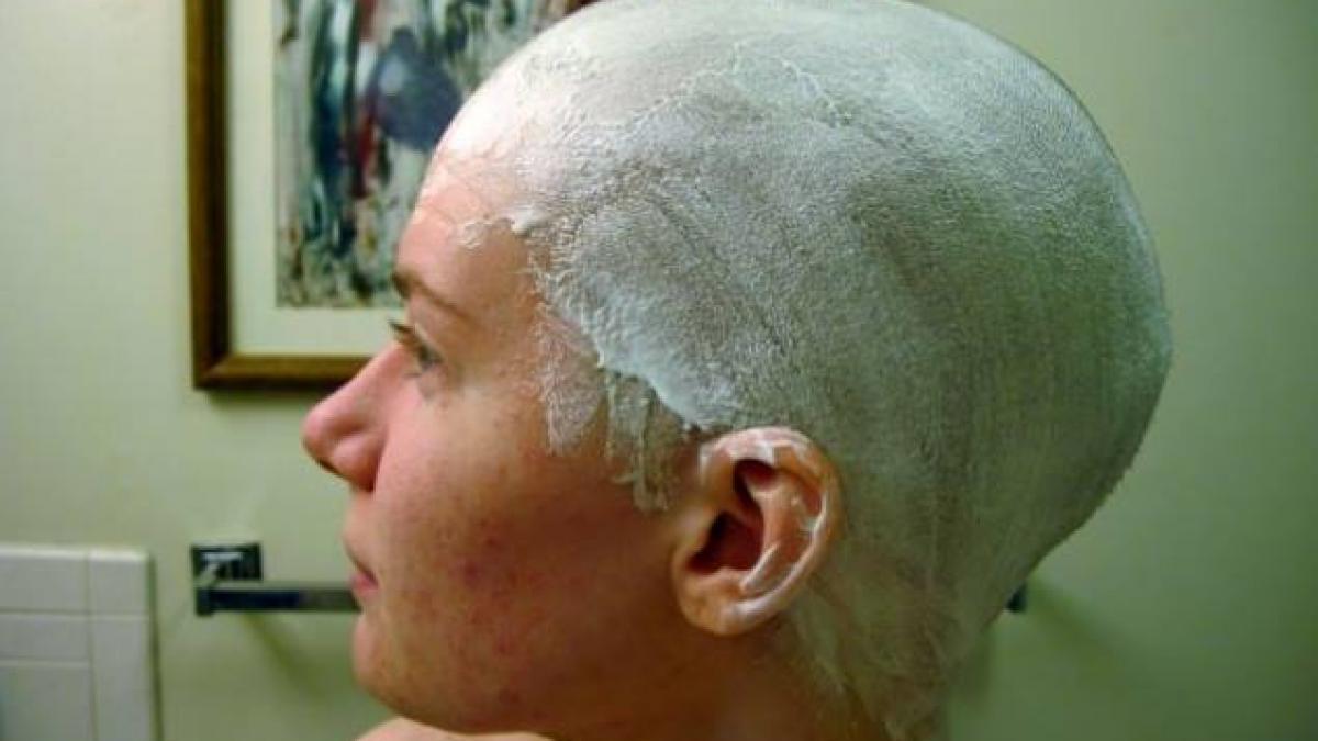 incepuse sa ii cada parul si sa aiba chelie asa ca si a dat cu mujdei de usturoi pe cap nu credea