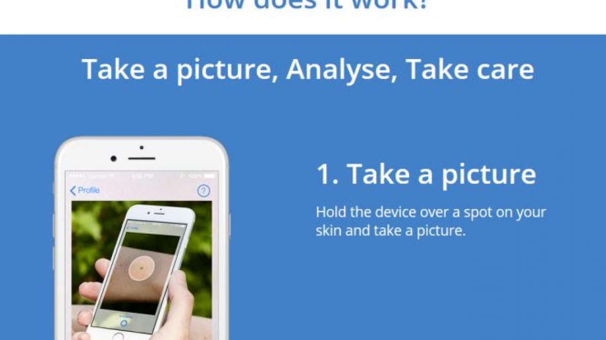 o aplicatie creata de romani ar putea putea revolutiona preventia cancerului de piele