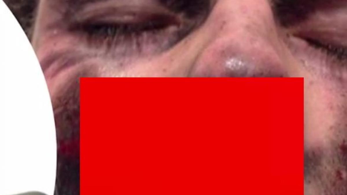 a vrut sa fumeze o tigara electronica ce a patit adolescentul il durea atat de tare incat spunea ca