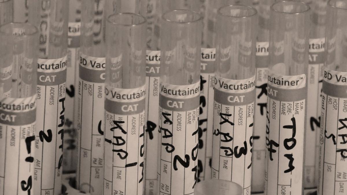 in romania nu se pot face teste concludente pentru depistarea virusului zika