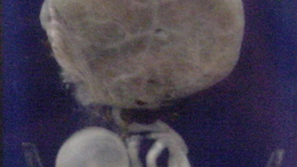 a asistat la un avort apoi si a dat demisia era viu si plangea dar a trebuit sa l las sa moara