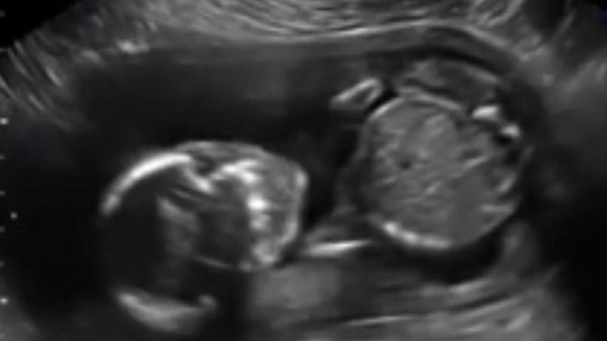 s a dus sa si faca o ecografie si a avut parte de un soc pe bune se intampla in corpul meu