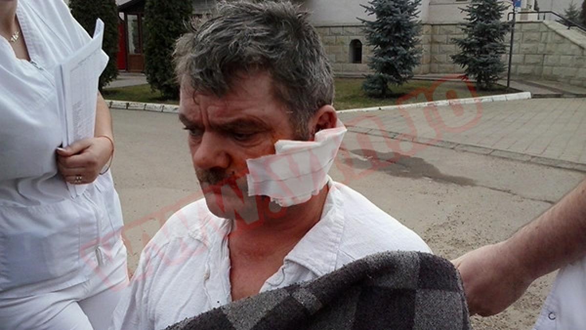 A supraviețuit în mod miraculos după ce vecinul i-a înfipt un cuțit în cap. Medicii s-au crucit când l-au văzut! VIDEO
