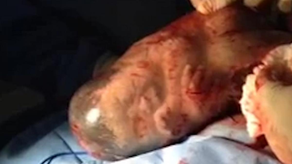imagini impresionante momentul in care un bebelus este eliberat din sacul amniotic