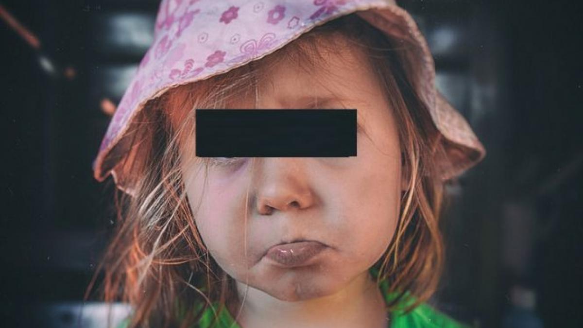 un milion de romani sufera majoritatea fara sa stie de o boala rara