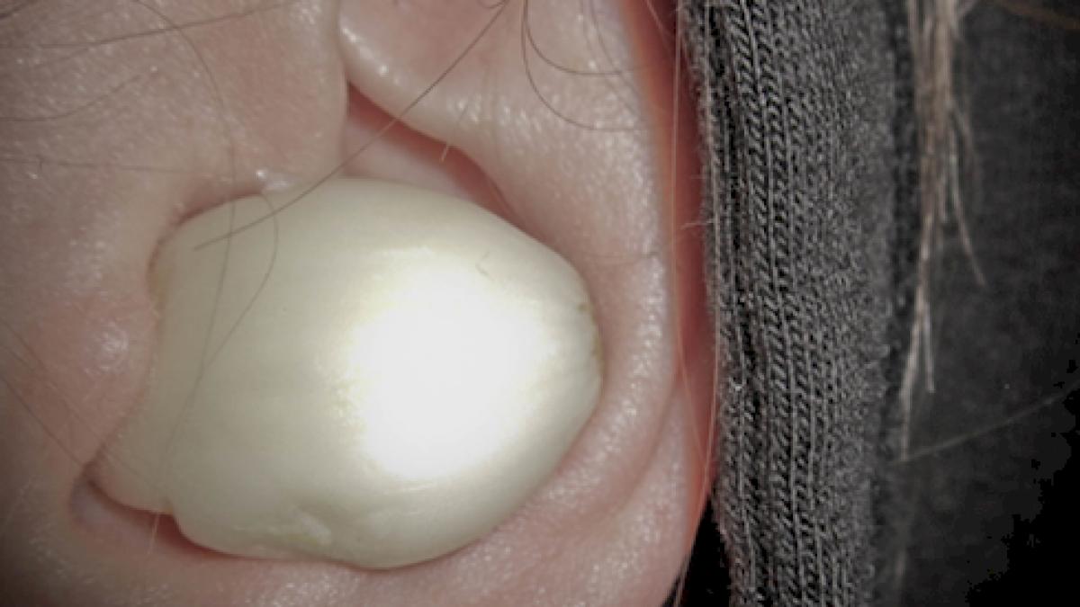 si a pus usturoi in ureche ce i s a intamplat femeii