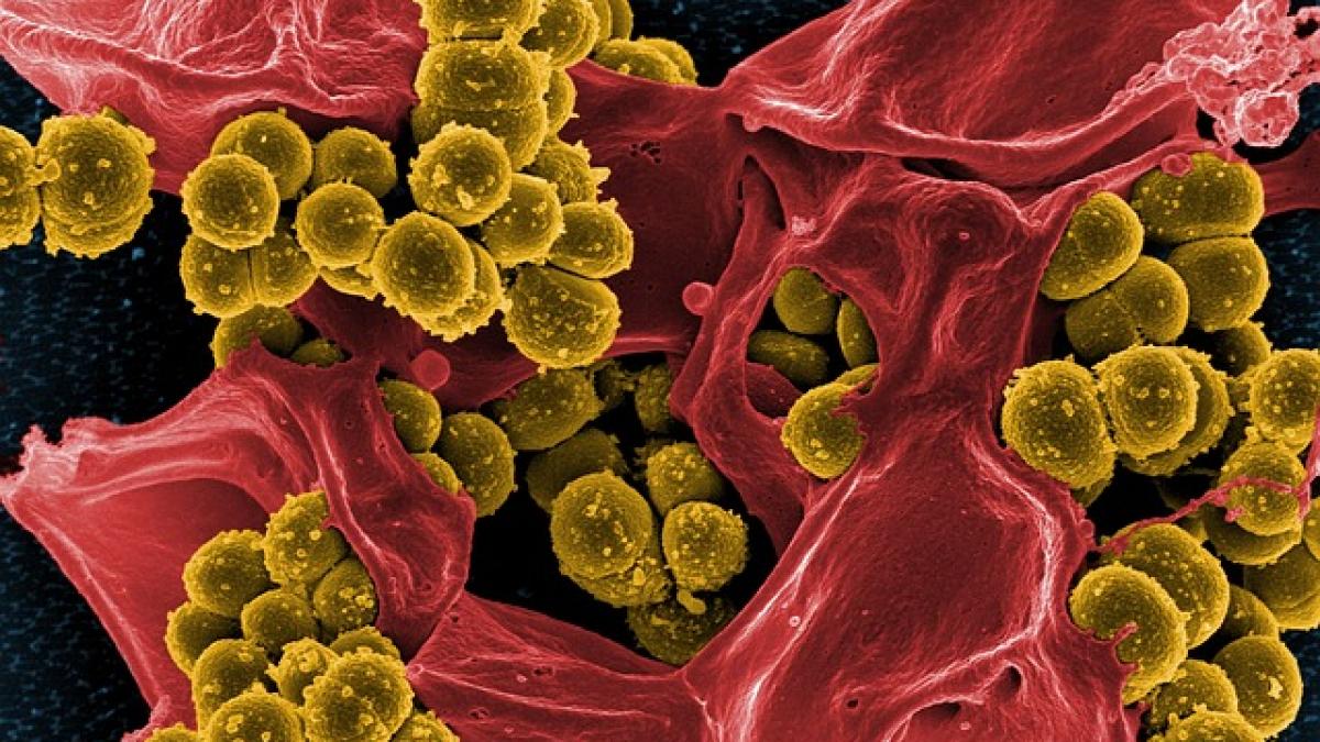 bacterie periculoasa descoperita la spitalul judetean suceava