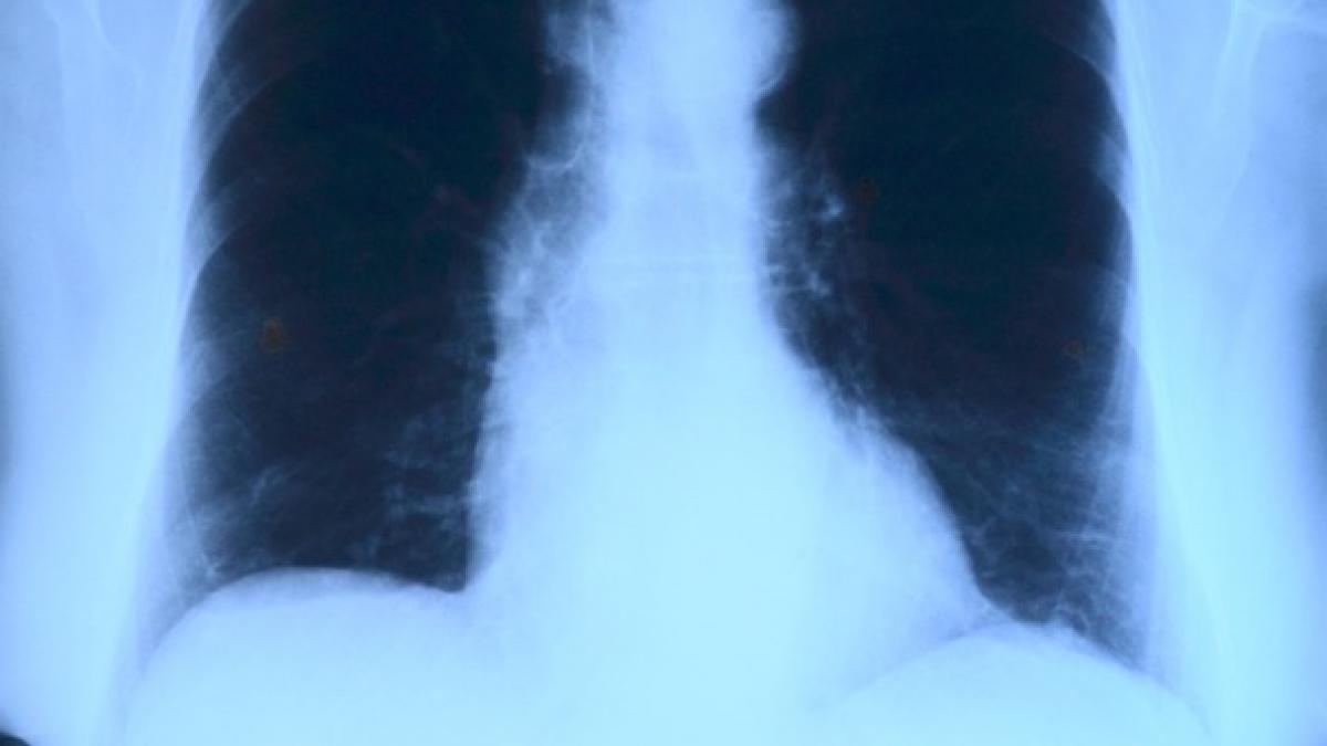 descoperire infioratoare in trupurile victimelor atentatelor din bruxelles medicii in stare de soc