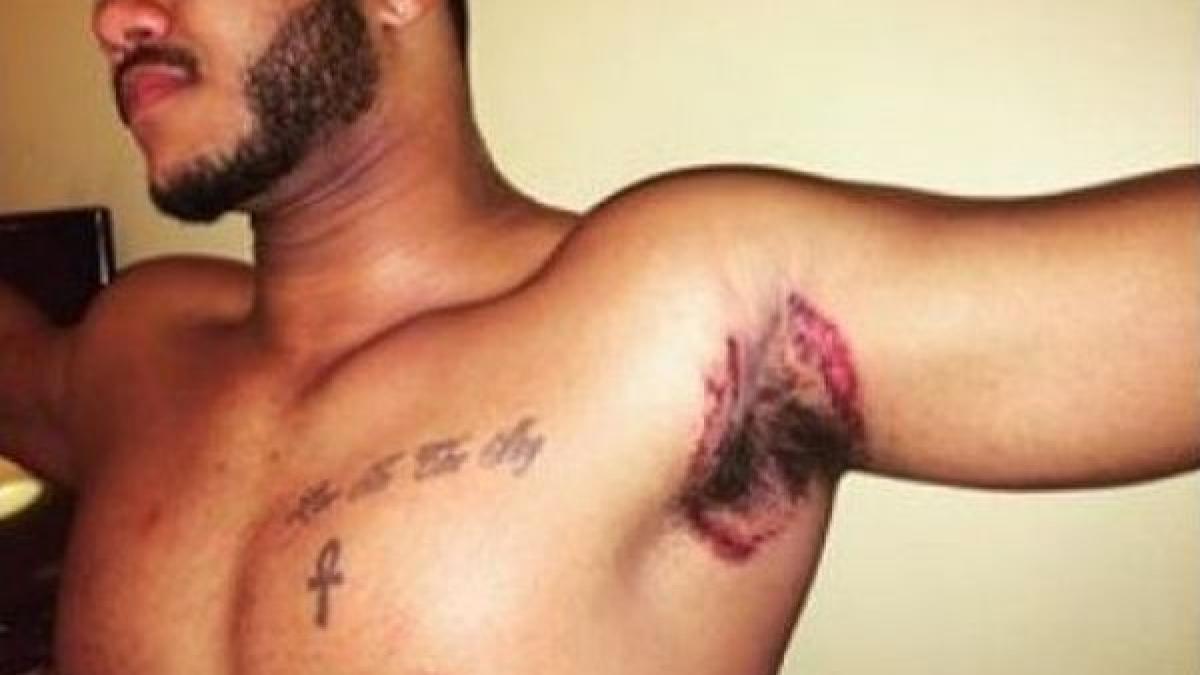 sute de americani se plang ca s au ales cu iritatii dupa ce au folosit un cunoscut deodorant