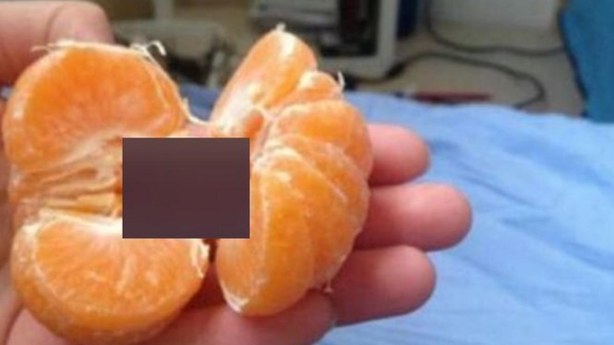 a decojit o portocala si a facut o descoperire uluitoare imaginea a devenit virala pe internet