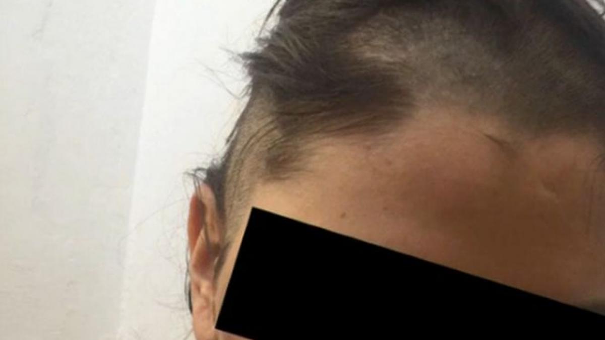 fiica unui om de afaceri din pitesti isi acuza tatal ca a snopit o in bataie si a ras o in cap