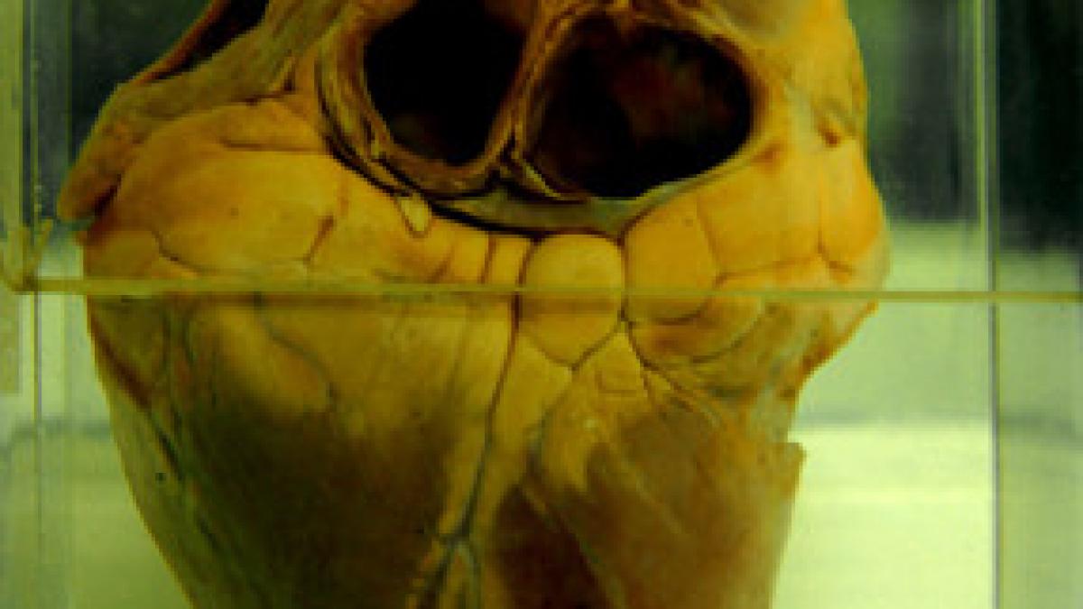 prima inima perfect functionala creata in laborator