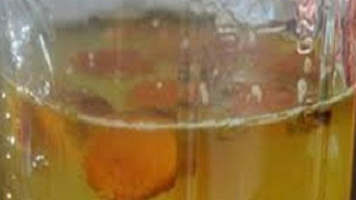 a baut apa calda cu turmeric in fiecare dimineata timp de 12 luni uite ce i s a intamplat apoi