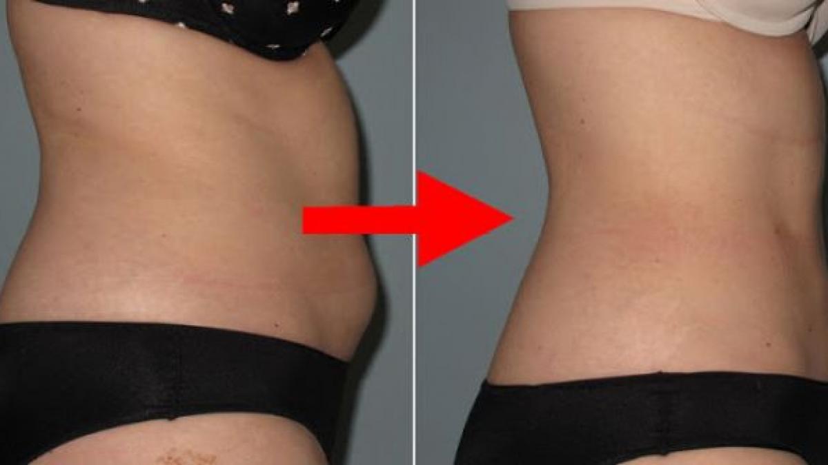 metoda de slabire sau de mentinere a greutatii fara infometare