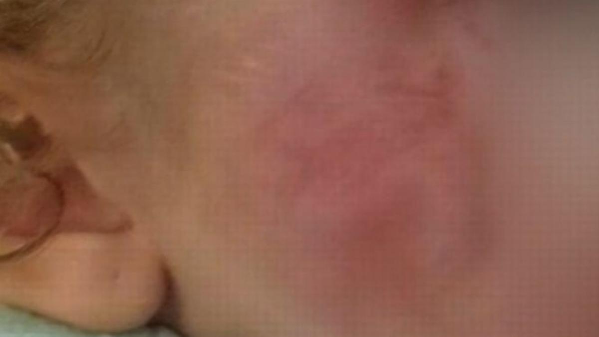 caz socant o fetita s a intors de la gradinita plina de rani si vanatai ce s a intamplat