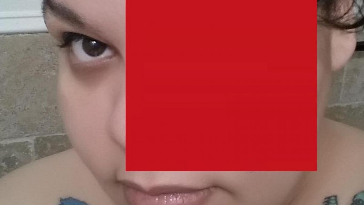 si a pierdut un ochi din cauza machiajului infectia s a raspandit rapid in organism