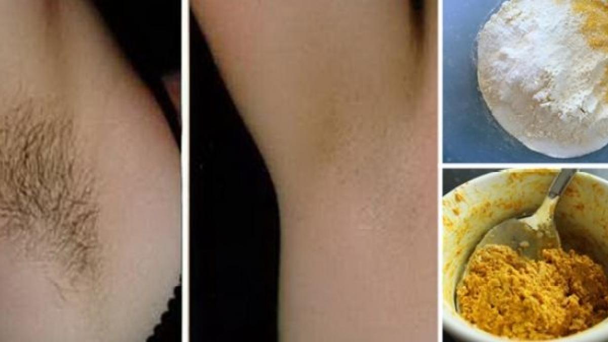 cum poti scapa de parul de la subrat definitiv in mod natural acasa