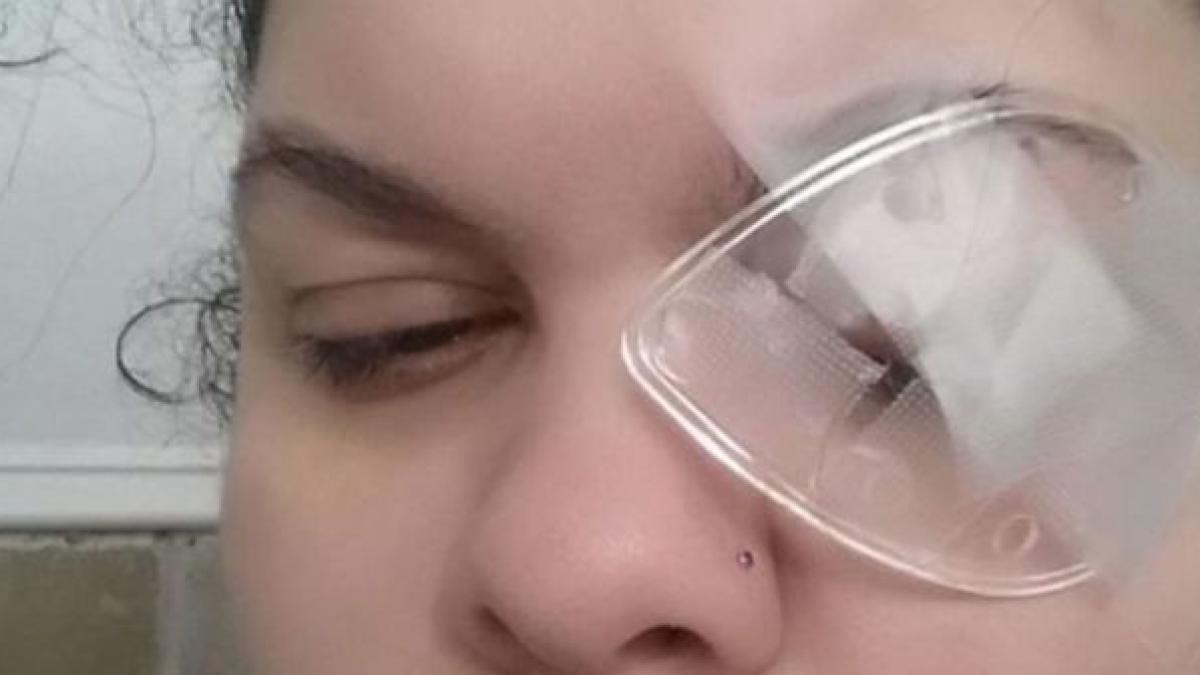 drama unei femei a ramas fara un ochi din cauza produselor de make up folosesti asta zilnic