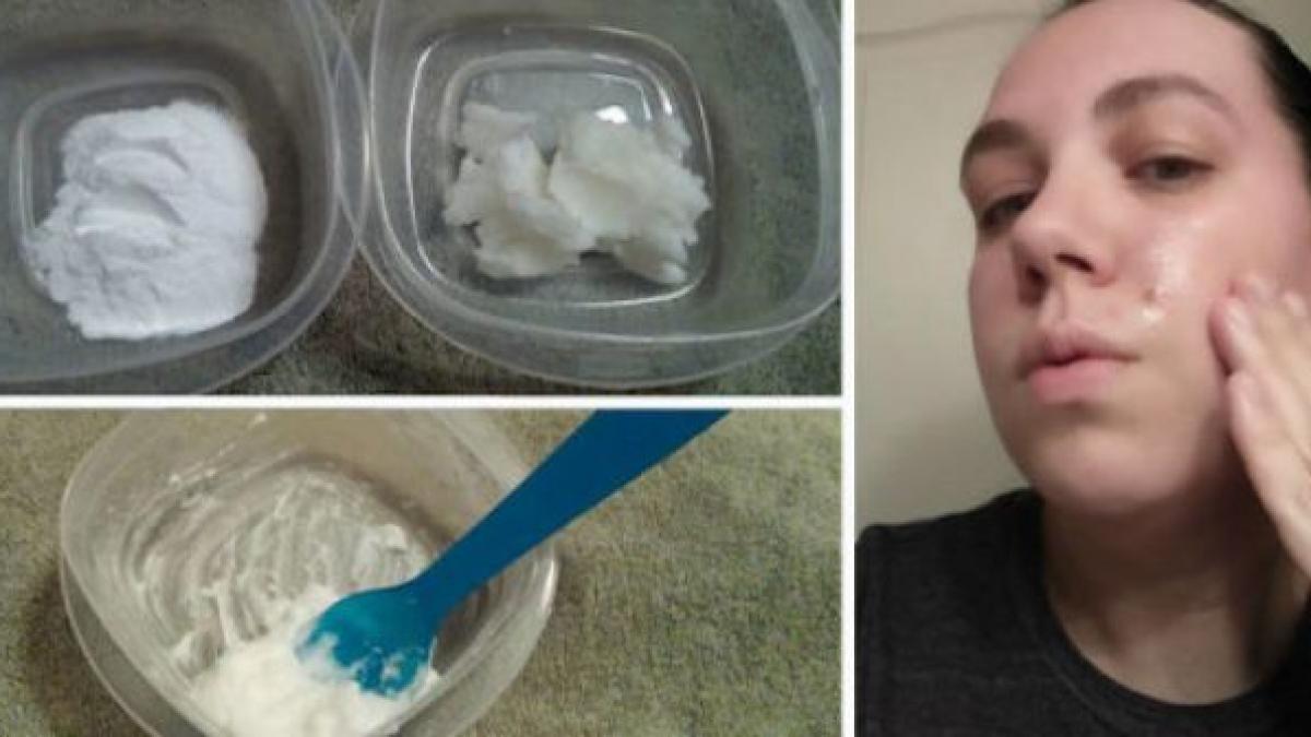 genial s a spalat pe fata cu ulei de cocos si bicarbonat de trei ori pe saptamana ce i s a