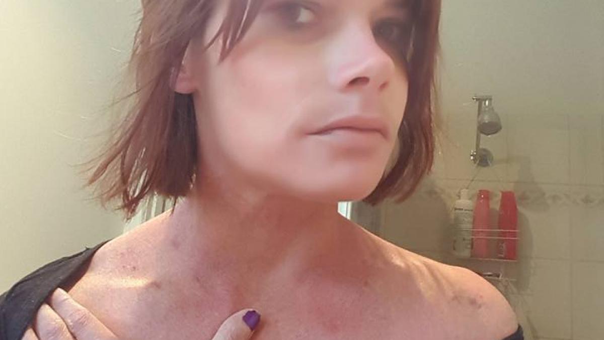 imagini socante fotografiile postate pe facebook de o femeie dupa ce a fost violata de un barbat pe