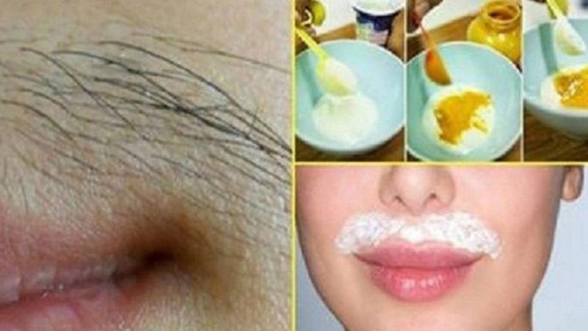 a amestecat trei ingrediente si a scapa de parul de pe fata pentru totdeauna vezi aici reteta