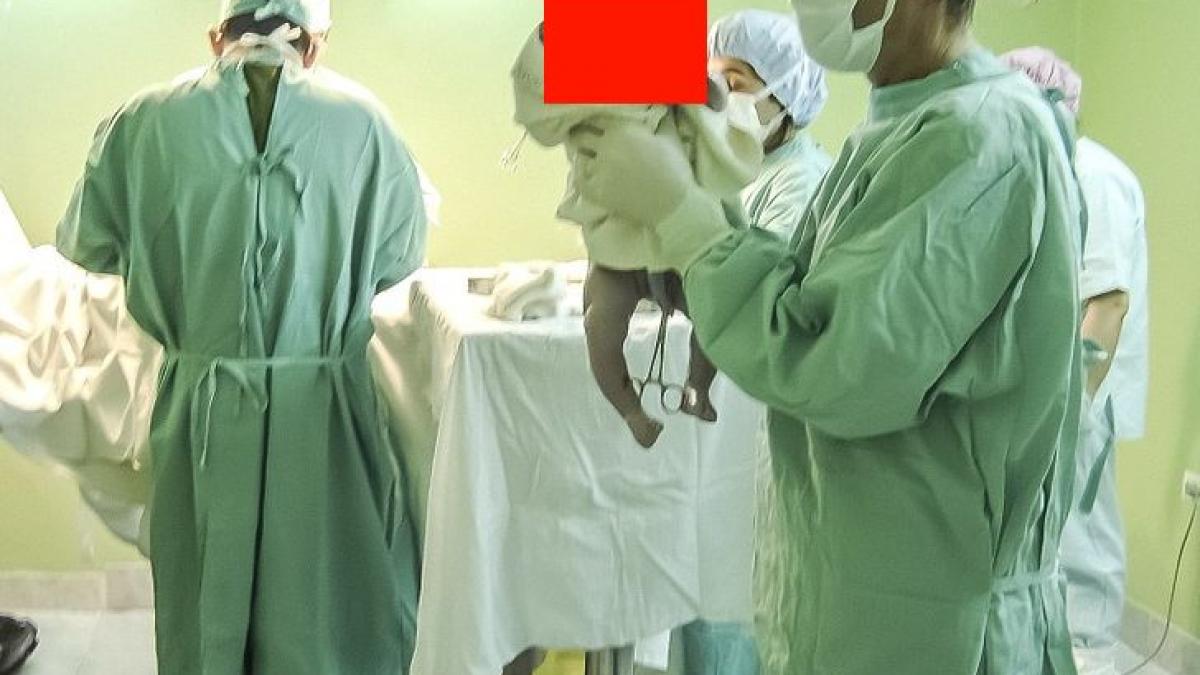 au crezut ca vor avea un copil sanatos cand l au vazut parintii au izbucnit in plans cum arata