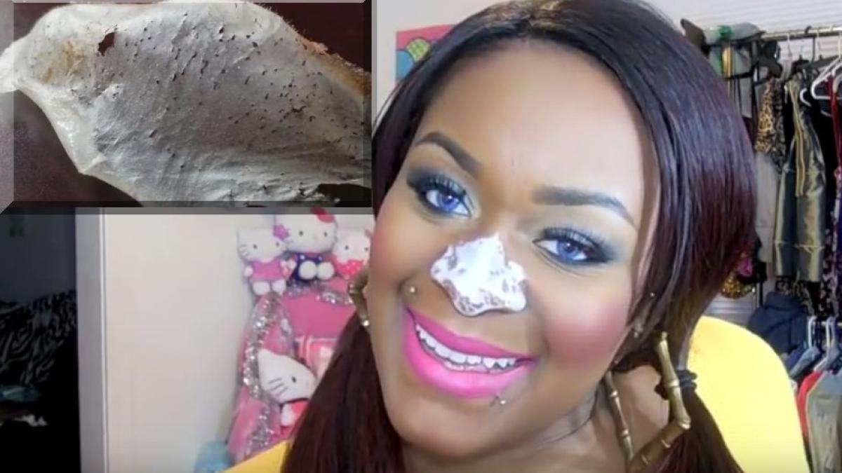 si a pus lipici pe fata ca sa scape de punctele negre rezultatul este uimitor video