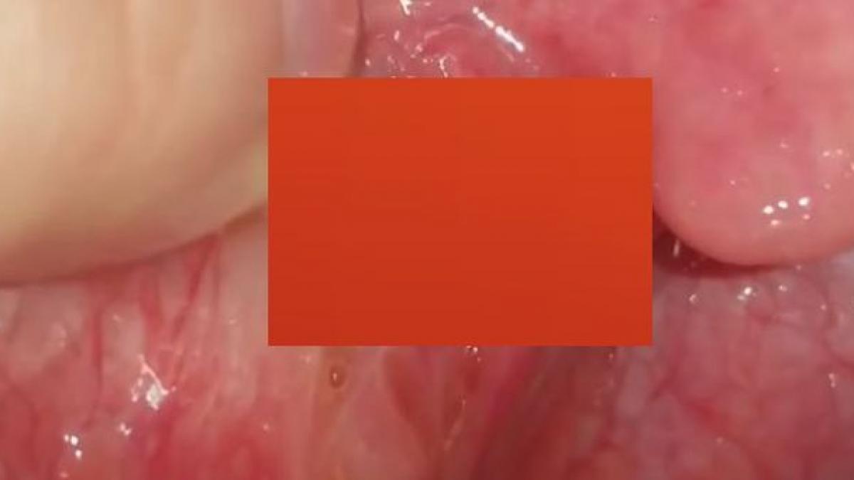 a mers la dentist pentru ca avea respiratie urat mirositoare e incredibil ce a descoperit