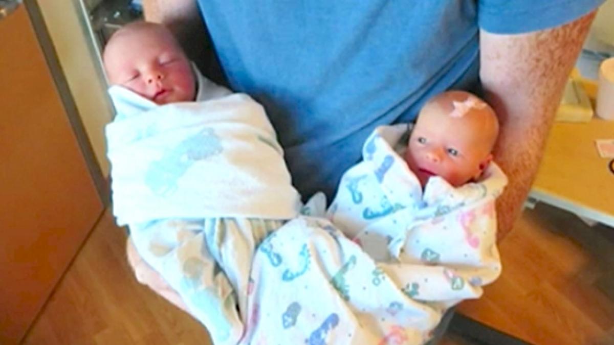 la scurt timp dupa ce a nascut gemeni medicii au observat o diferenta uluitoare intre ei toti