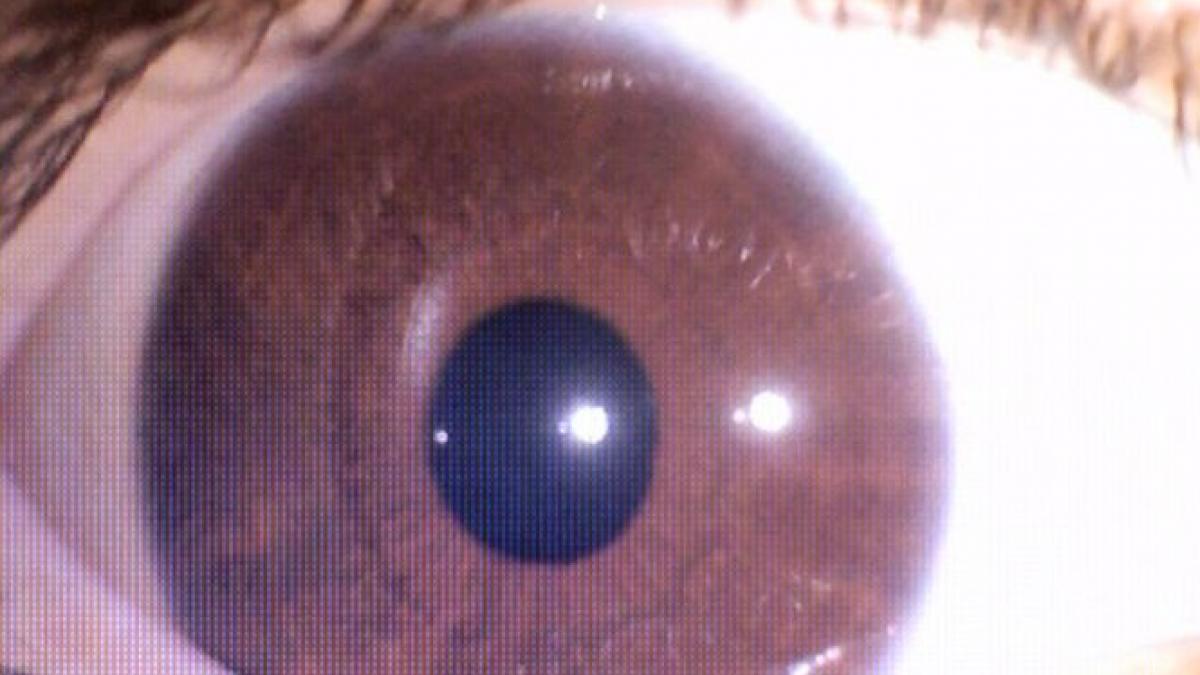 numai de bine sanatatea se poate citi in ochi