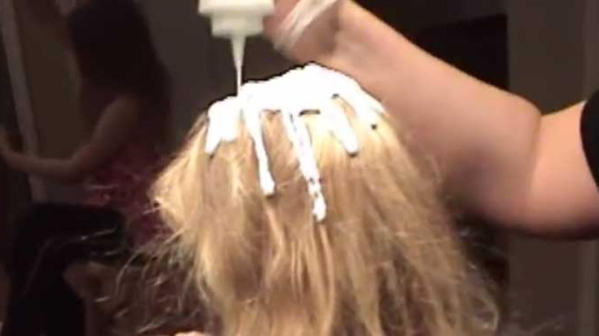 i au turnat in cap maioneza copilului ca sa scape de paduchi nici prin gand nu le a trecut ce