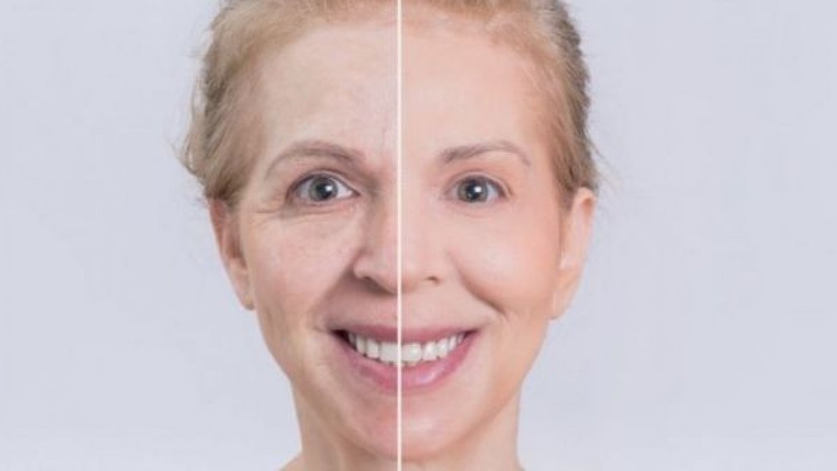 tratament anti-îmbătrânire de reînnoire a ochilor remedii naturale anti-îmbătrânire acasă