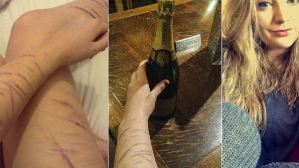 a refuzat sa o serveasca dupa ce i a vazut mainile secretul dureros din spatele imaginii