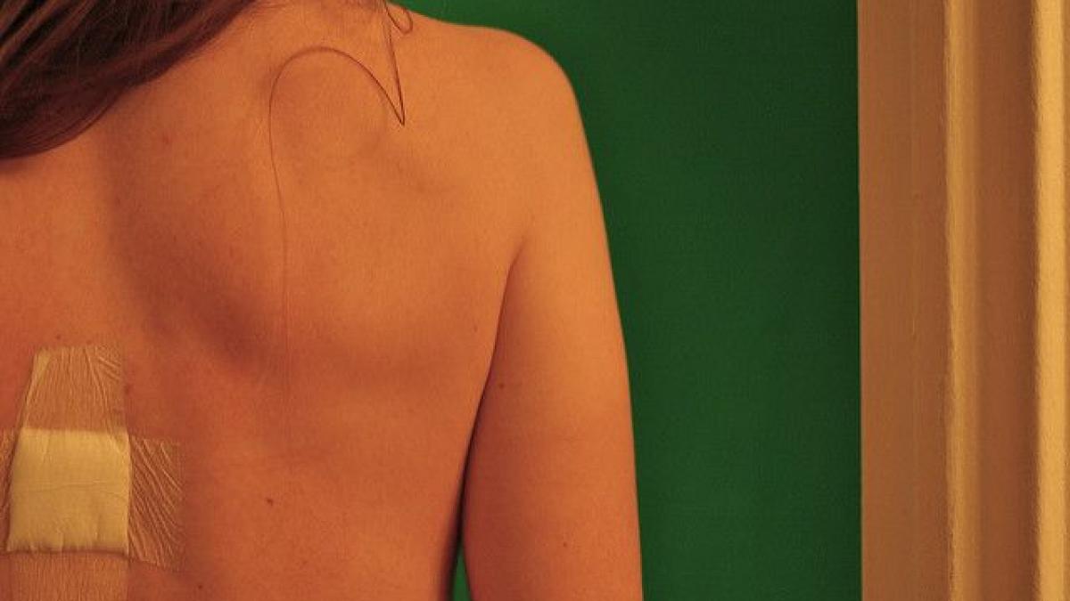 cum identifici alunitele cancerigene in 5 pasi