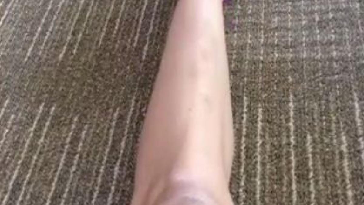 era o tanara frumoasa dar a ajuns de nerecunoscut cum arata fata dupa ce a slabit zeci de kilograme