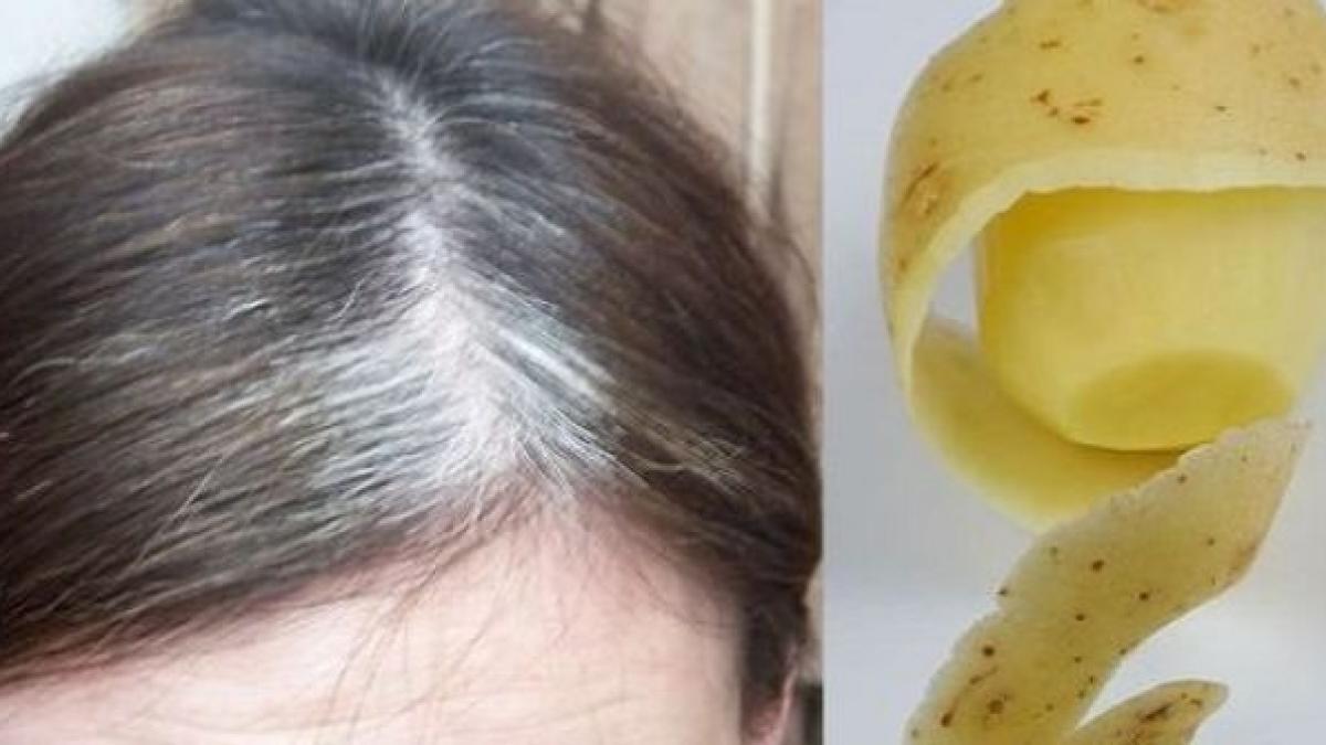 si a aplicat coji de cartofi pe par si a scapat de una dintre cele mai mari probleme a femeilor ce