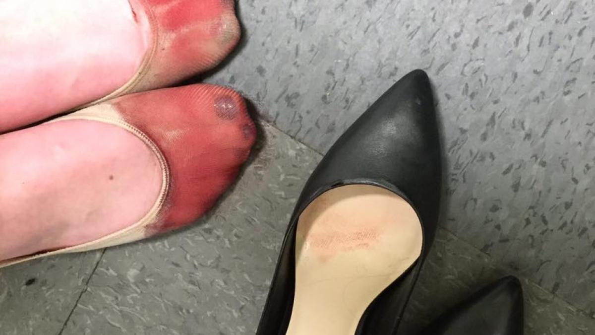 cum arata picioarele unei chelnerite dupa o zi de munca