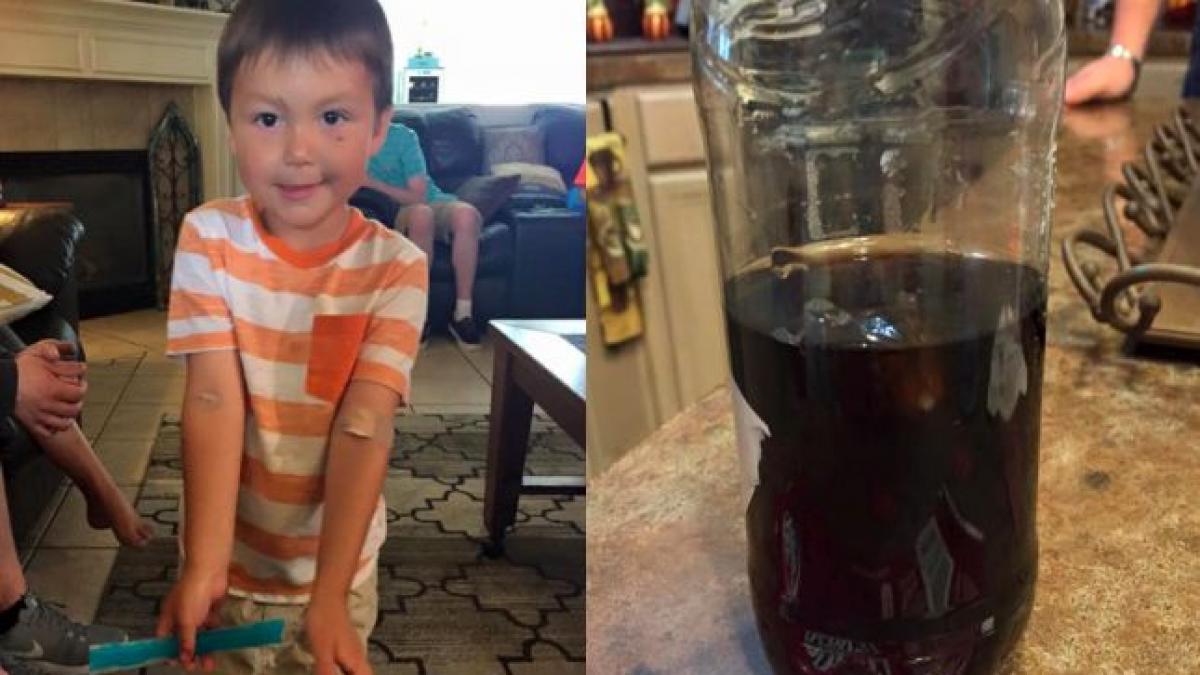 imaginile care te vor face sa nu mai bei suc niciodata ce a descoperit un baietel intr o sticla