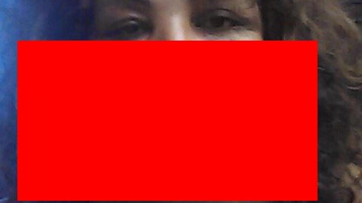 rajee narinesingh operatie estetica