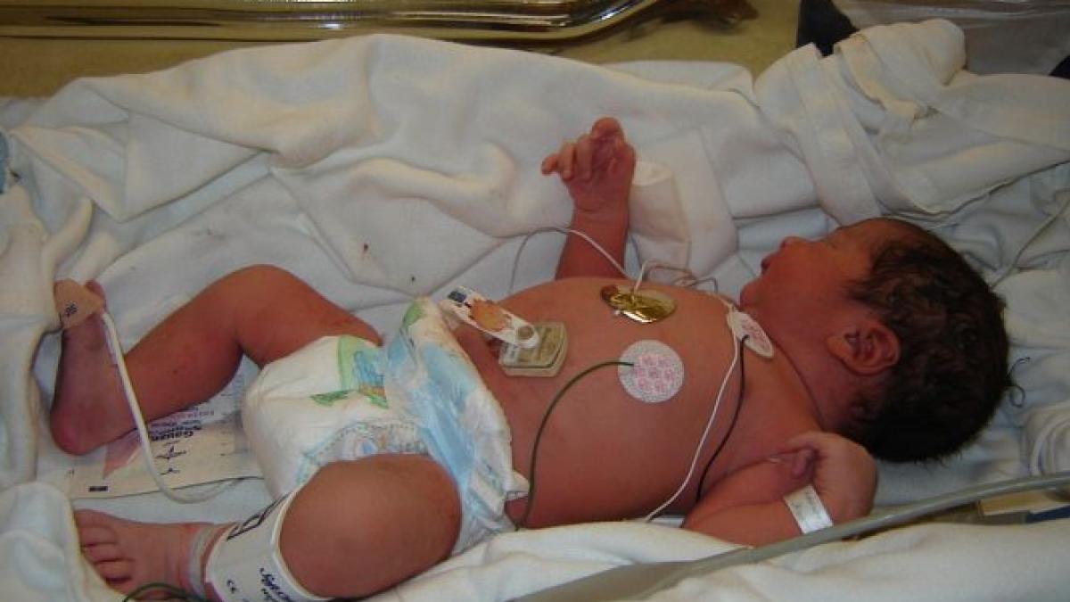 alti doi copii cu sindrom hemolitic uremic internati in spital