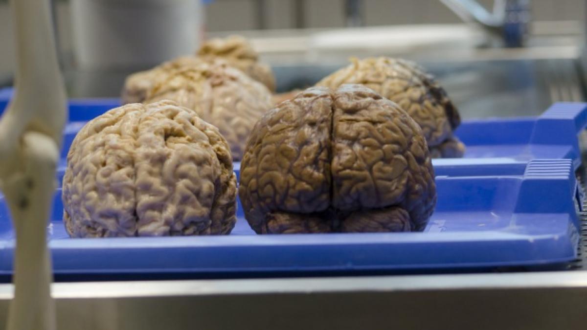 primele masuri de ajutor in caz de accident vascular cerebral