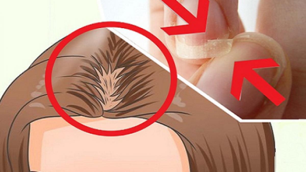 nu poti sa dormi ti se rup unghiile si iti cade parul uite ce deficienta uriasa ai in organism si