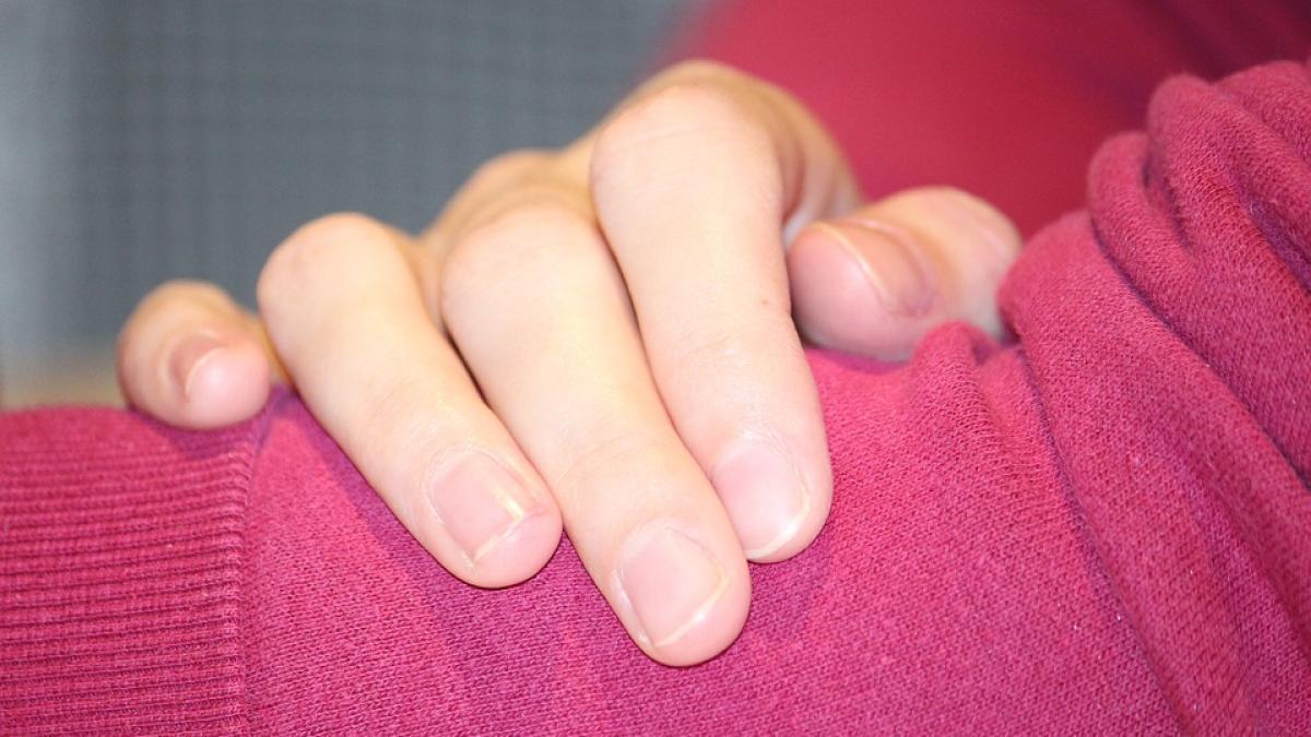 cancer de piele semne