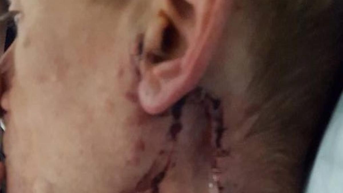 asta ti se poate intampla daca fumezi