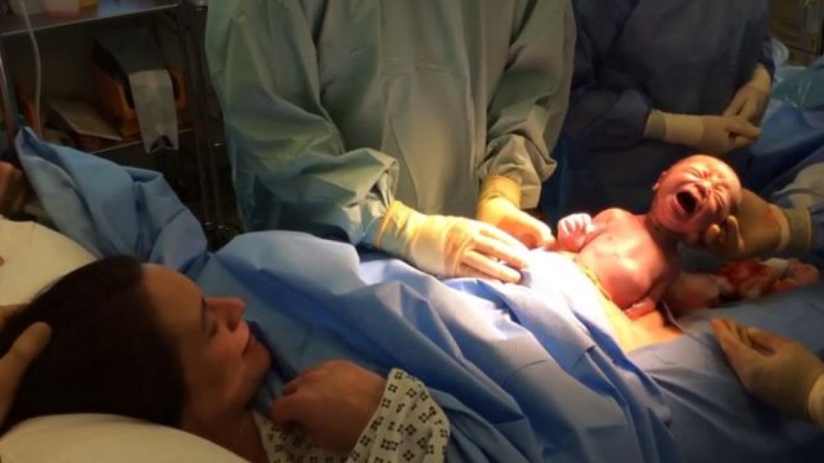 imagini fenomenale momentul in care un bebelus iese din pantecul mamei sale