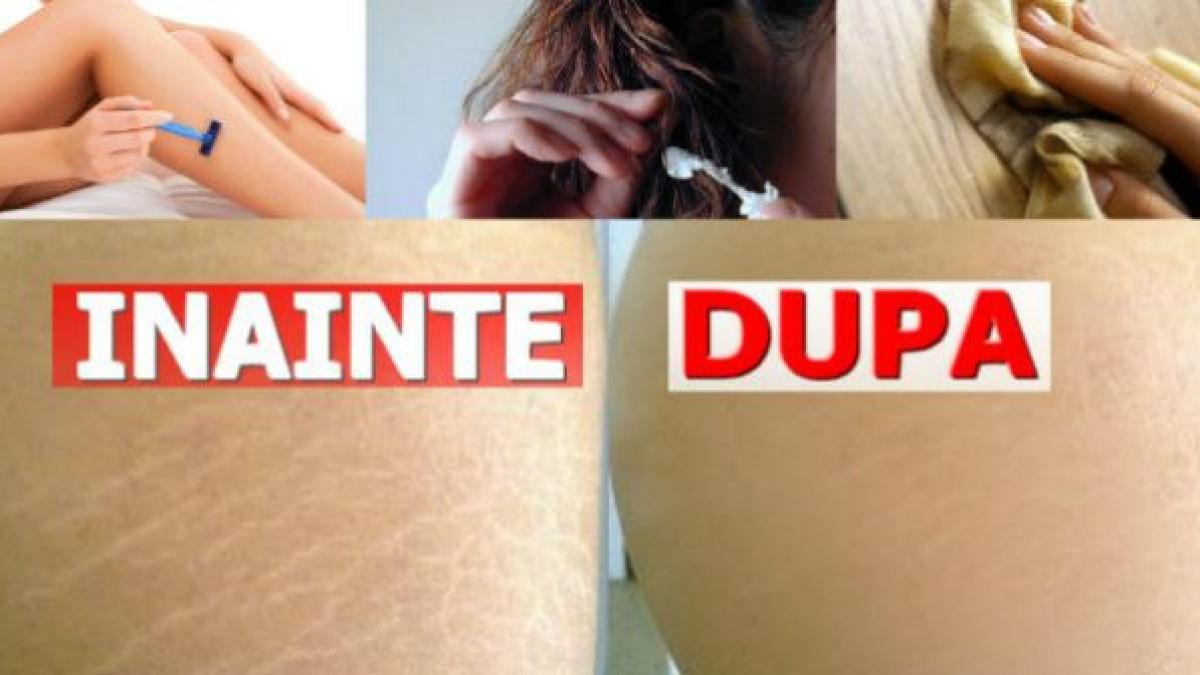 produsul minune care te scapa de o multime de probleme costa cativa lei insa e bun la toate