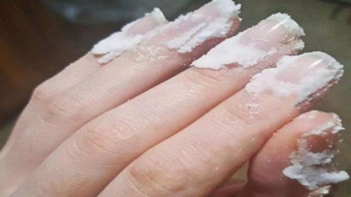 si a masat bicarbonat de sodiu pe unghii si ce i s a intamplat trucul asta iti va schimba si tie