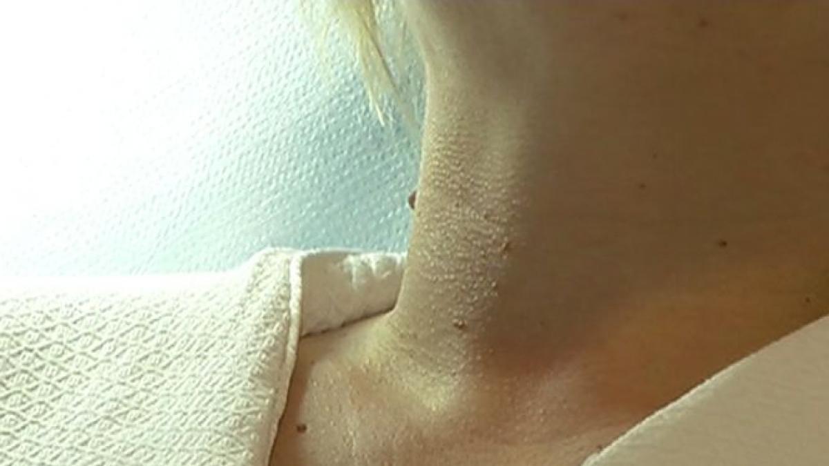 numai de bine virusul care face ravagii vara